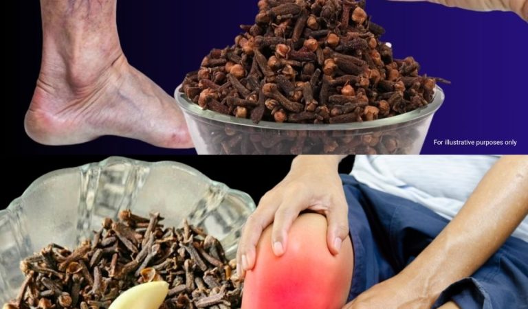 Natural Remedy for Leg Pain, Rheumatism, Varicose Veins, and Arthritis: Try Garlic & Cloves! Natural Remedy for Leg Pain, Rheumatism, Varicose Veins, and Arthritis: Try Garlic & Cloves!