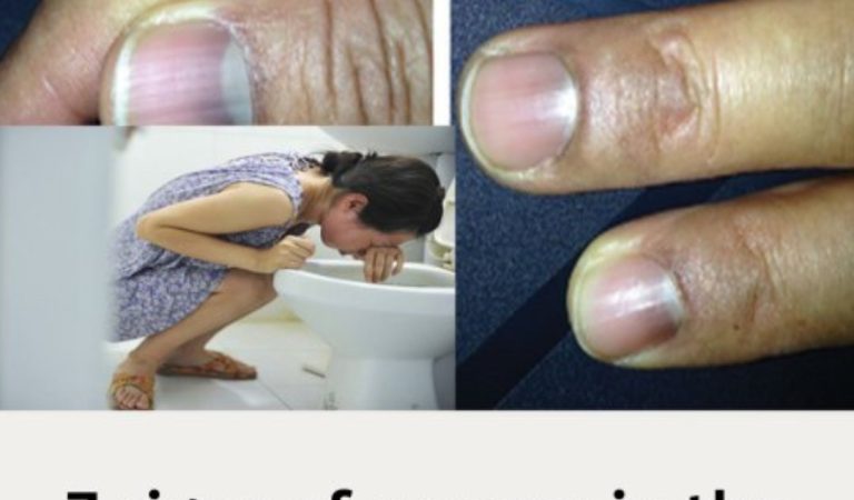 7 signs of canc3r in the morning when waking up without knowing